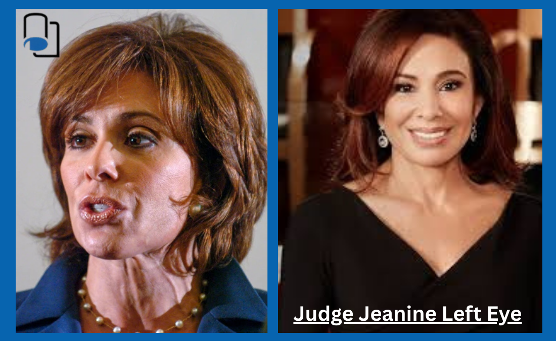 Judge Jeanine Left Eye