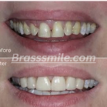 Brasssmile.com