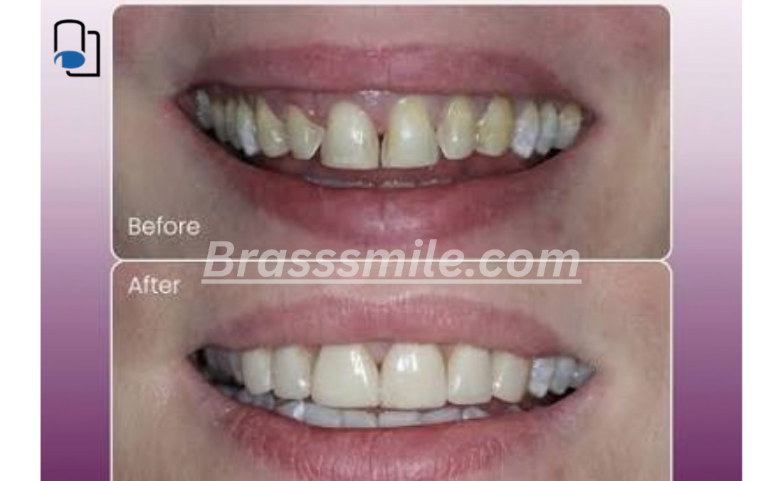 Brasssmile.com